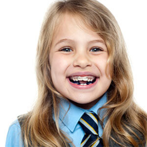 Image of a Child with braces - Children's Orthodonitcs